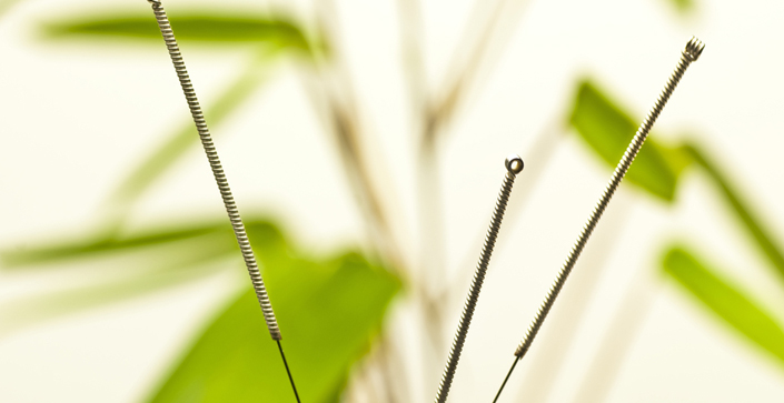 How Long will the Effect of Acupuncture Last