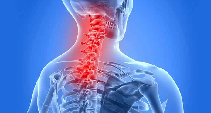 How Can I Relieve My Neck Pain